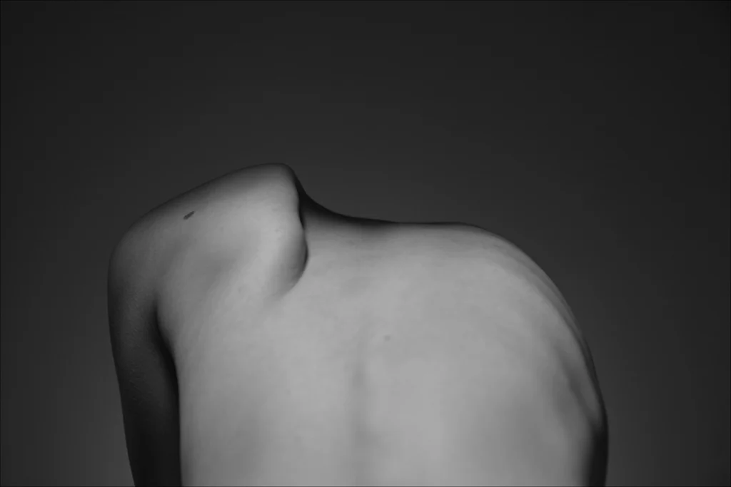 Shoulder pain chiropractor for safe and natural healing.