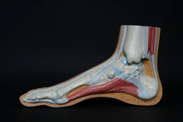 Chiropractor for plantar fasciitis.
