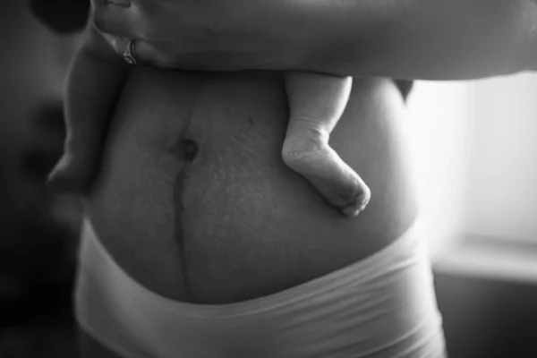 Chiropractic care for postpartum moms.